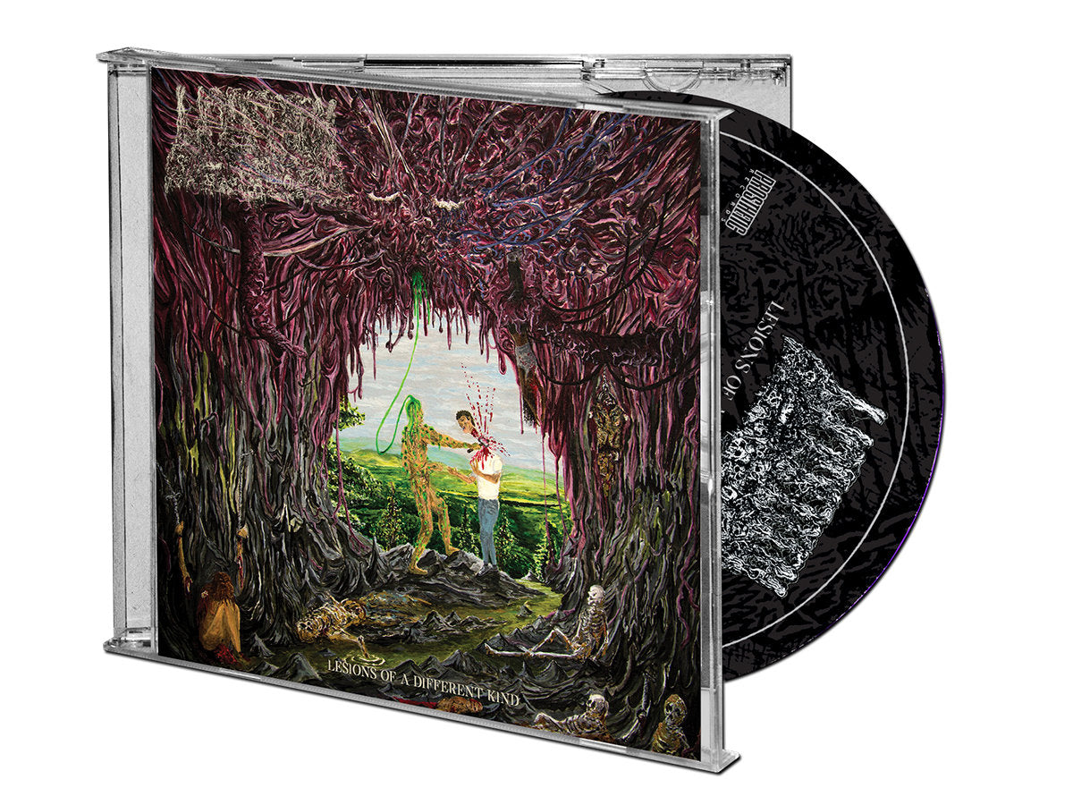 Undeath - Lesions of a Different Kind Music CD