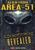 Alien From Area 51: Alien Autopsy Footage Revealed - Alien From Area 51: Alien Autopsy Footage Revealed - DVD