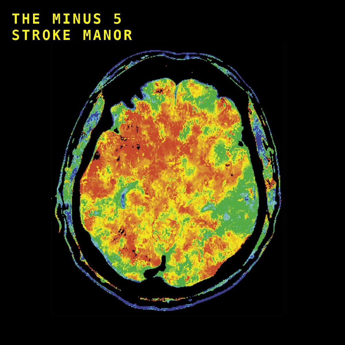 Minus 5, The - Stroke Manor (Indie Exclusive, Red, Orange, Yellow Brainwave Vinyl) Vinyl Record