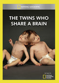Twins Who Share A Brain - Twins Who Share A Brain - DVD