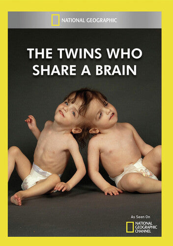 Twins Who Share A Brain - Twins Who Share A Brain - DVD