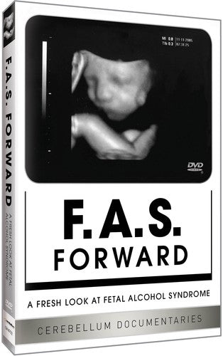 Fas Forward: Fresh Look At Fetal Alocohol - Fas Forward: Fresh Look At Fetal Alocohol - DVD