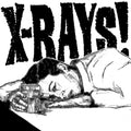 X-rays - Jameson Shot - Vinyl Record