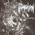 Glossectomy - Impediments From Dysplasia - Music CD