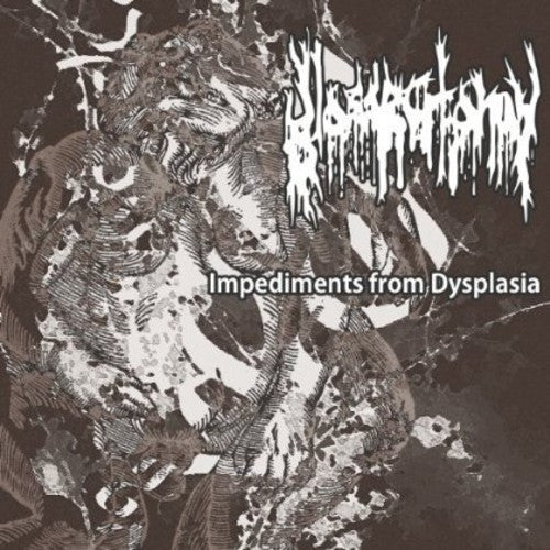 Glossectomy - Impediments From Dysplasia - Music CD