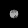 Scntst - 4friendz - Vinyl Record