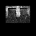 Cristi Cons & Dewalta - Infinity - Vinyl Record