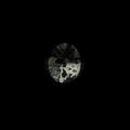 Zombies Under Stress - Stalin - Vinyl Record