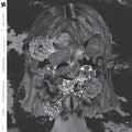 La Fleur - Flowerhead Reprise - Vinyl Record