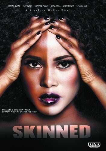 Skinned - Skinned - DVD