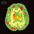 Minus 5 - Stroke Manor - Music CD