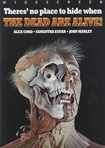 Dead Are Alive - Dead Are Alive - DVD