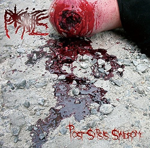 Porifice - Post-sepsis Syndrome - Music CD
