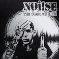 Noise - Scars We Hide - Music CD