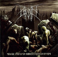 Putridity - Mental Prolapse Induced Necrophilism - Music CD
