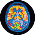 Frankey & Sandrino - Brainscan - Vinyl Record