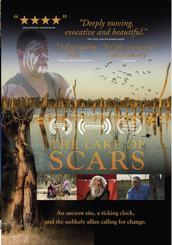 Lake Of Scars - Lake Of Scars - DVD