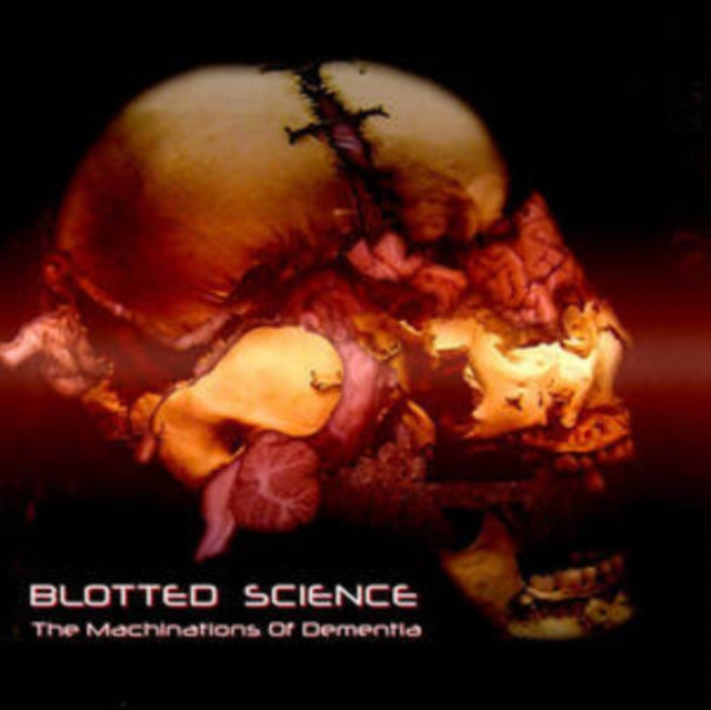 Machinations Of Dementia