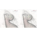 Dream (Milky Clear LP Vinyl) (I) & Dream