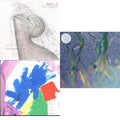 Alt-J - Dream (Milky Clear LP Vinyl) (I) & This Is All Yours (Neon Yellow LP Vinyl) & Awesome Wave