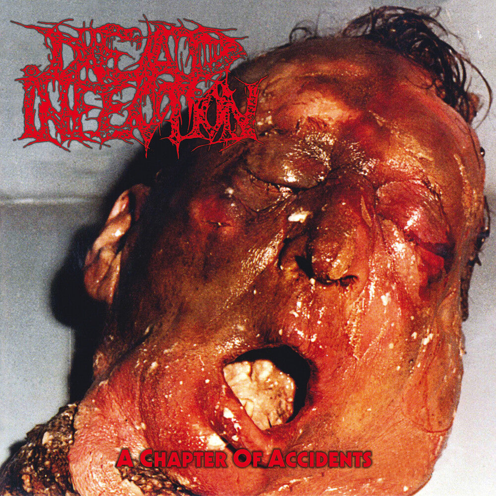 Dead Infection – Chapter of Accidents Music CD