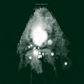 Barnett & Coloccia - VLF |