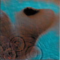 Meddle
