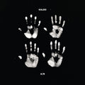 Kaleo - A/B (Indie Exclusive) [Black & White Vinyl] [2LP] Vinyl Record