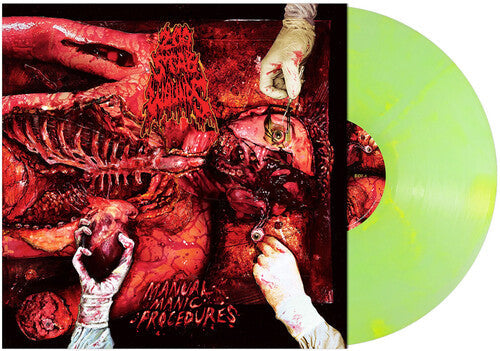 200 Stab Wounds - (PRESALE 6/12/26) Manual Manic Procedures (GREEN YELLOW VINYL) | Mint (M) Mint (M)