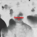 JONGHO - Confrontation (VINYL) | Mint (M) Mint (M)