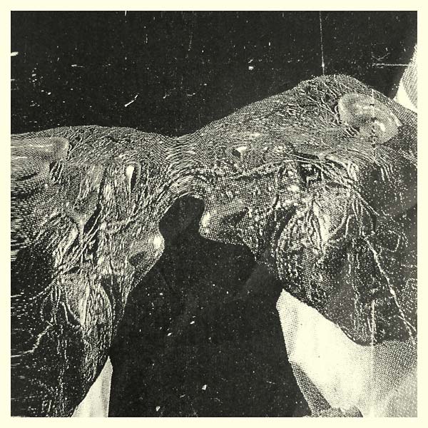 Memory Care Unit Vinyl Record